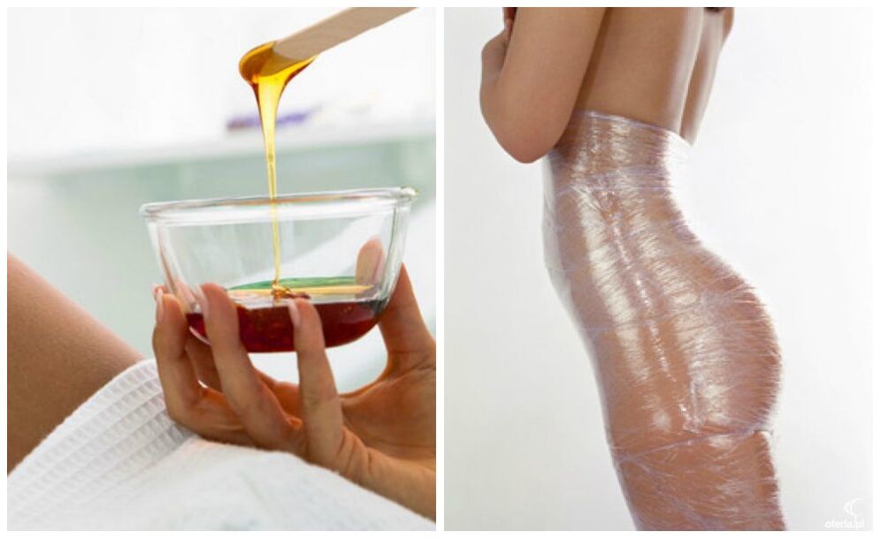 tělové zábaly na hubnutí